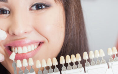 Affordable Modern Dental Implants Wellington Point