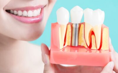 Are Dental Implants Right for You?