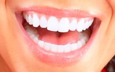 Dentist Wellington Point Guide – 12 Tips For Maintaining Your Dental Health During The Holidays