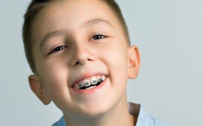 Wellington Point Dental Guide – Why It Is Important For Your Child To Get Braces?