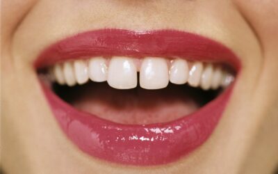Dentist Wellington Point Guide: Can Diabetes Affect Your Teeth and Gums