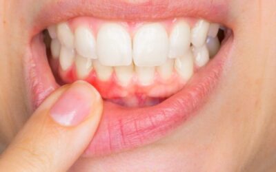 Dentist Wellington Point Guide: Gum Disease – The “Cure” Is Treatment, Then Prevention
