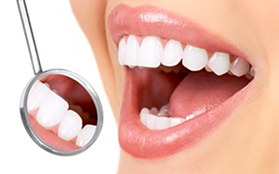 How much veneers cost in Wellington point?