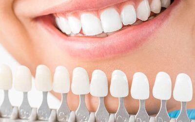 What are The Most Popular Cosmetic Dentistry Procedures