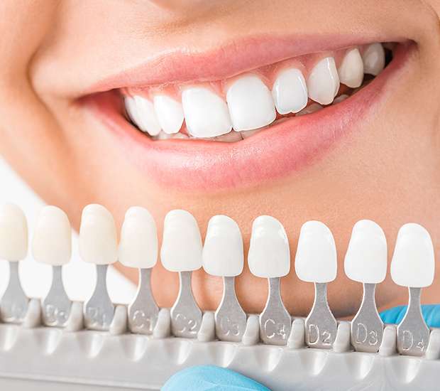 What are The Most Popular Cosmetic Dentistry Procedures