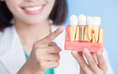 What is the Cost and Procedure for a Single Tooth Dental Implant?