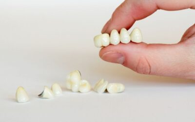 Dental Bonding vs Porcelain Veneers