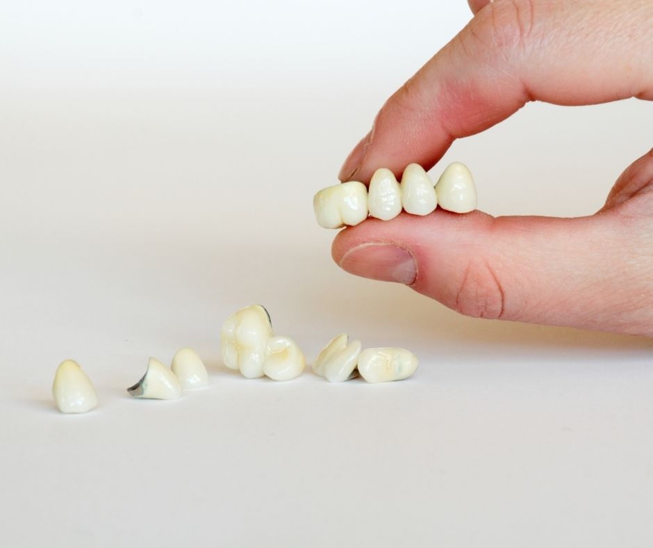 Dental Bonding vs Porcelain Veneers Dental Bonding vs Porcelain Veneers