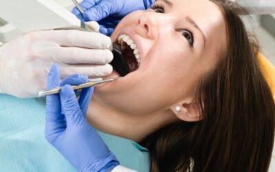 Myths About Porcelain Veneers Debunked