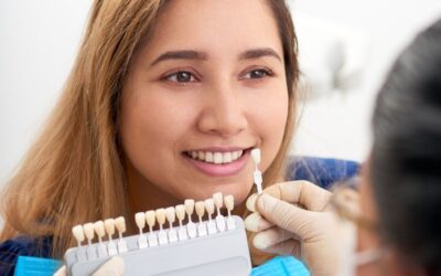 Why Are Temporary Veneers Important?