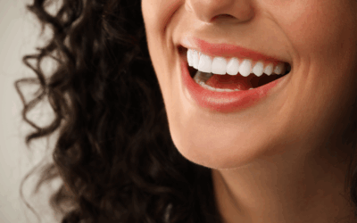 Composite Veneers in Wellington Point – How Effective It Is