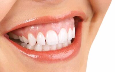 Cosmetic Dentistry in Wellington Point