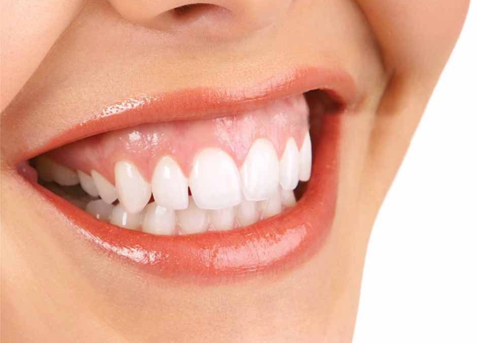 Cosmetic Dentistry in Wellington Point