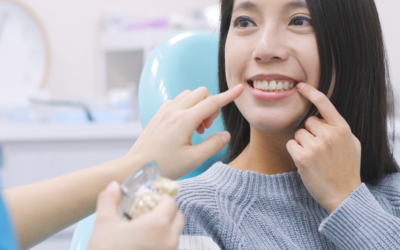 Can You Get A Root Canal With Veneers in Wellington Point?