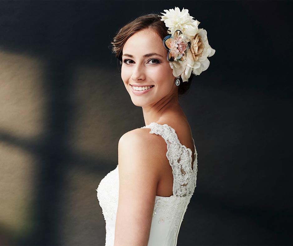 Composite Veneers For Fluorosis Composite Veneers For Fluorosis