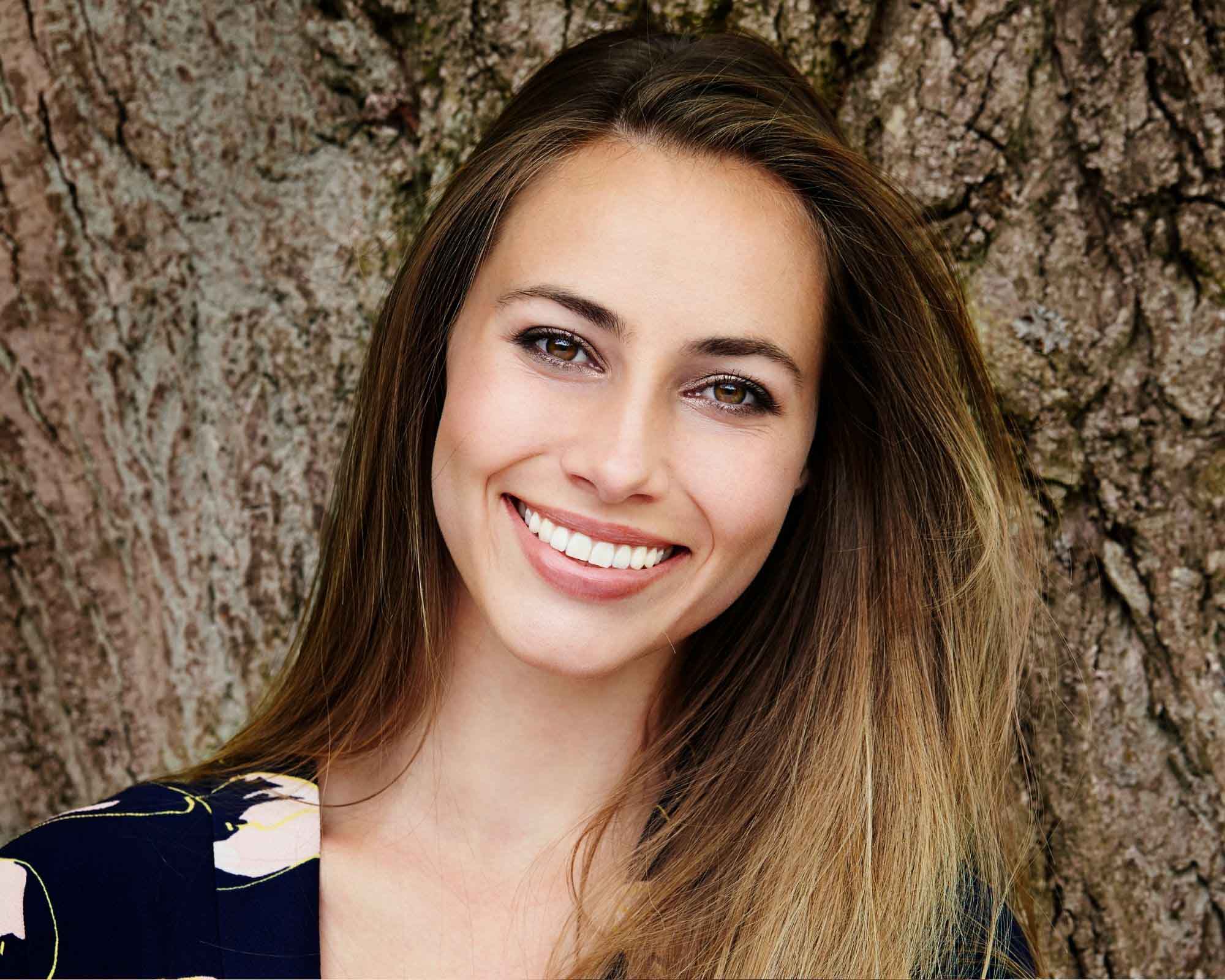 Wellington Point Porcelain Veneers Wellington Point Porcelain Veneers