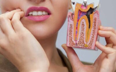 What to Expect When Removing Wisdom Teeth at Wellington Point