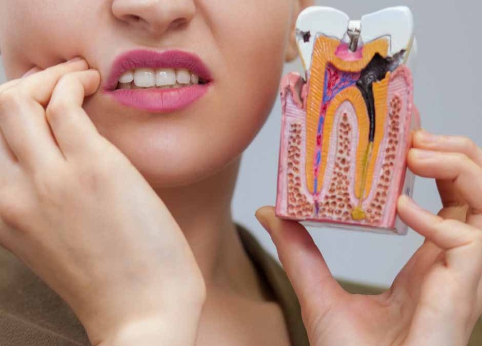 What To Expect When Getting Your Wisdom Tooth Removed At Wellington Point Dentist