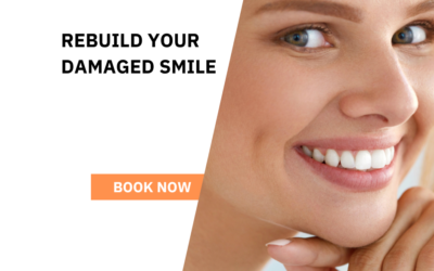 How To Save A Damaged Tooth In Wellington Point