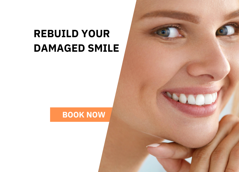 How To Save A Damaged Tooth In Wellington Point