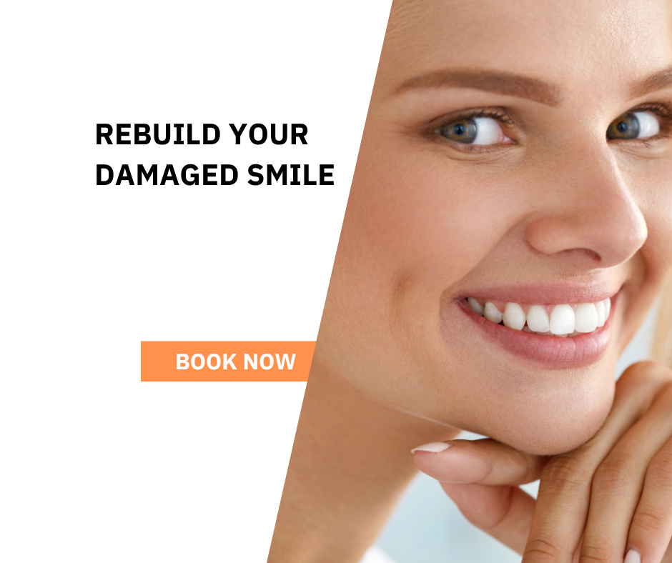 rebuild your damaged smile rebuild your damaged smile