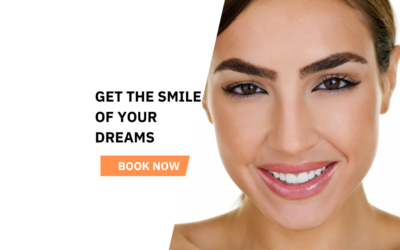 How to Care For Your Teeth After Dental Bonding in Wellington Point?