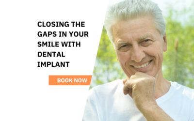 Dental Implants in Birkdale