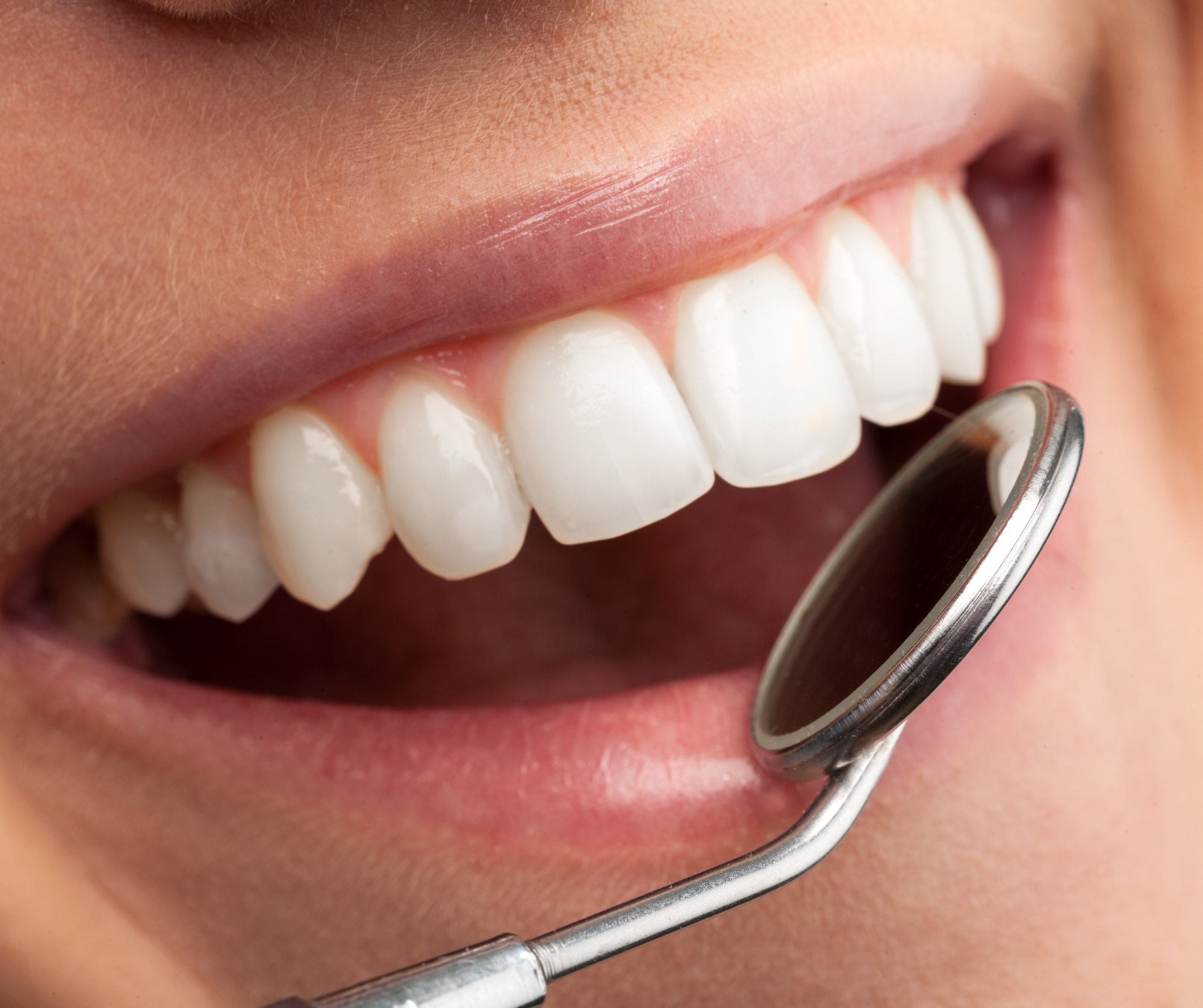 General Dentistry Wellington Point Dental