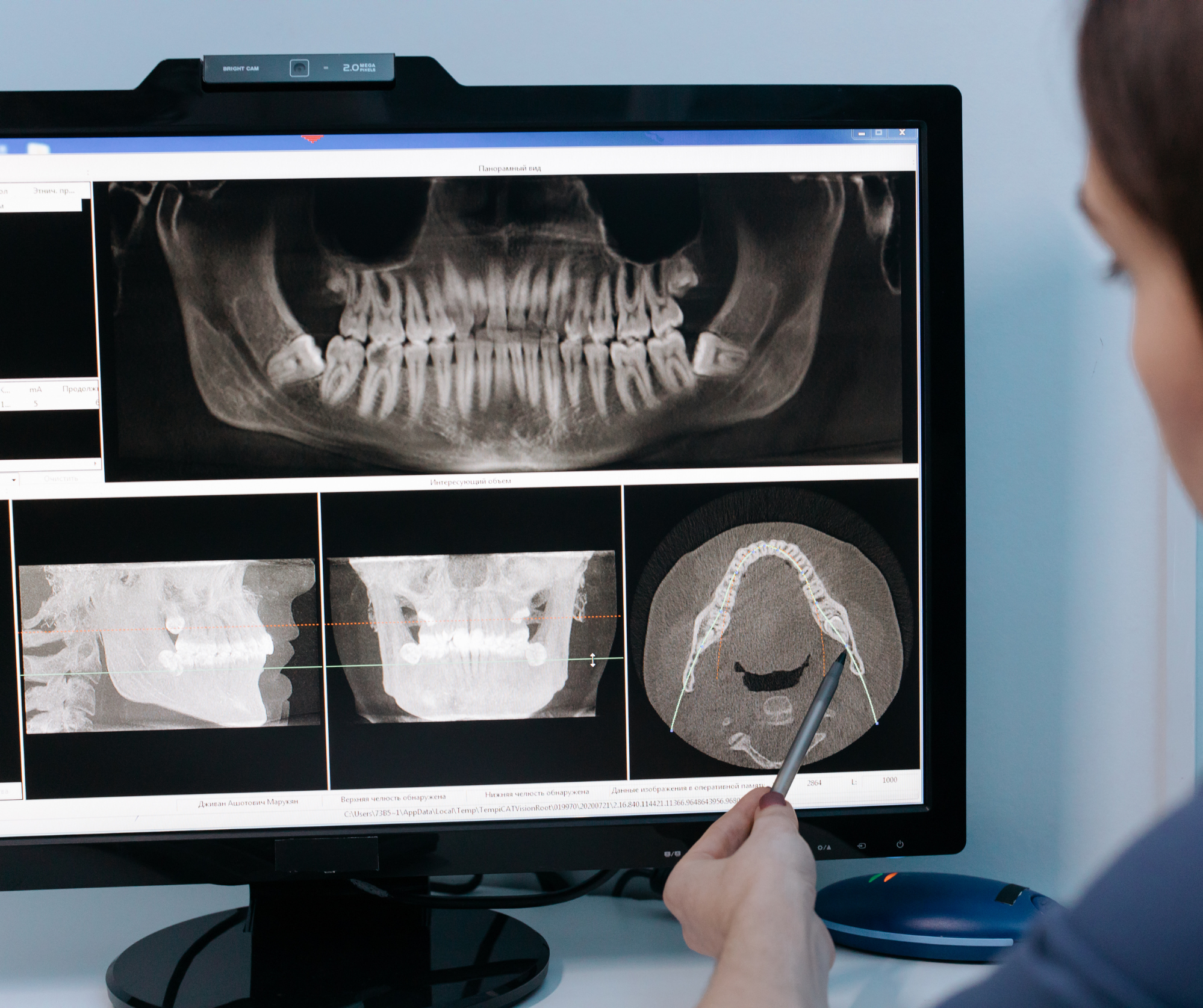 Dental Xrays Wellington Point Dental