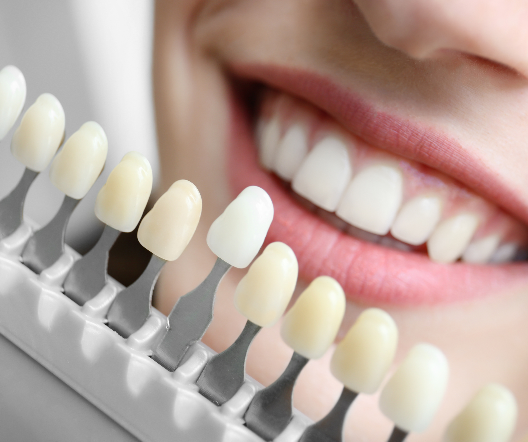 Cosmetic Dentistry at Wellington Point Dental