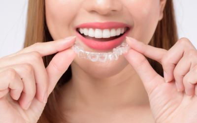 Clear Aligners in Birkdale | Confident Smile at Wellington