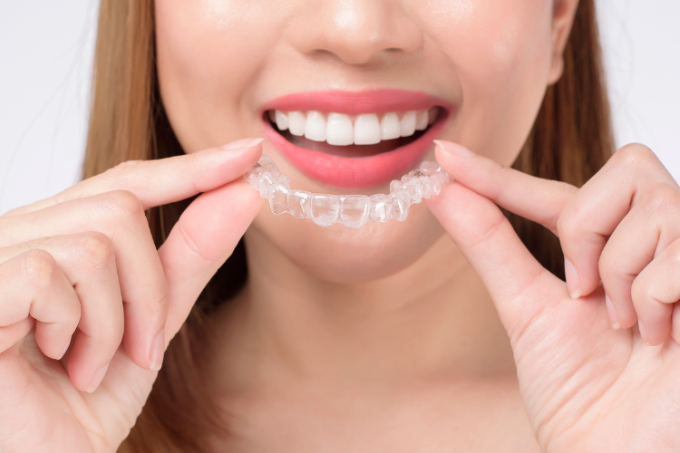 Clear Aligners in Birkdale Clear Aligners in Birkdale