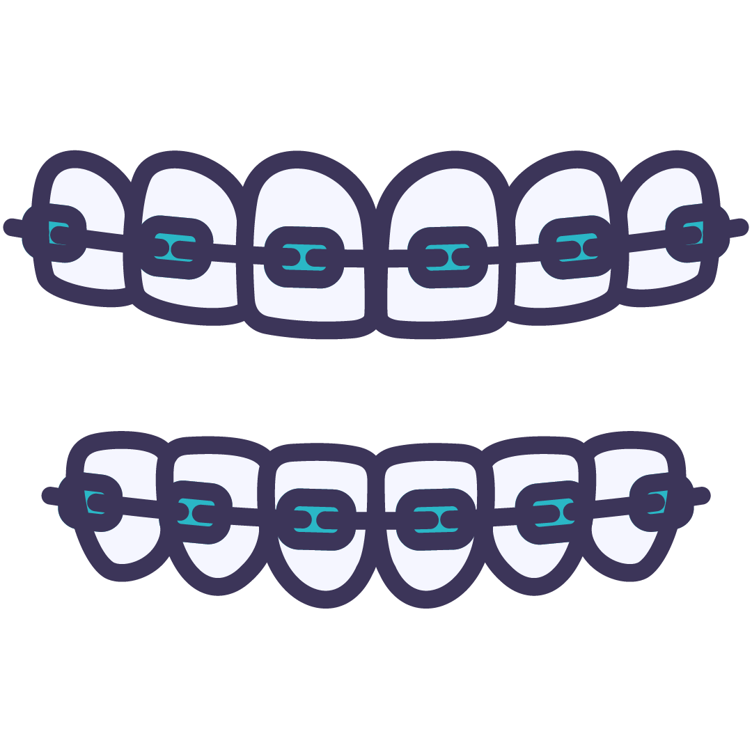 Braces | Wellington Point Dental Braces