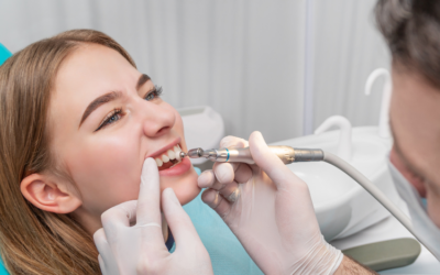 Teeth Cleaning in Birkdale: Why A Regular Teeth Clean Is Essential