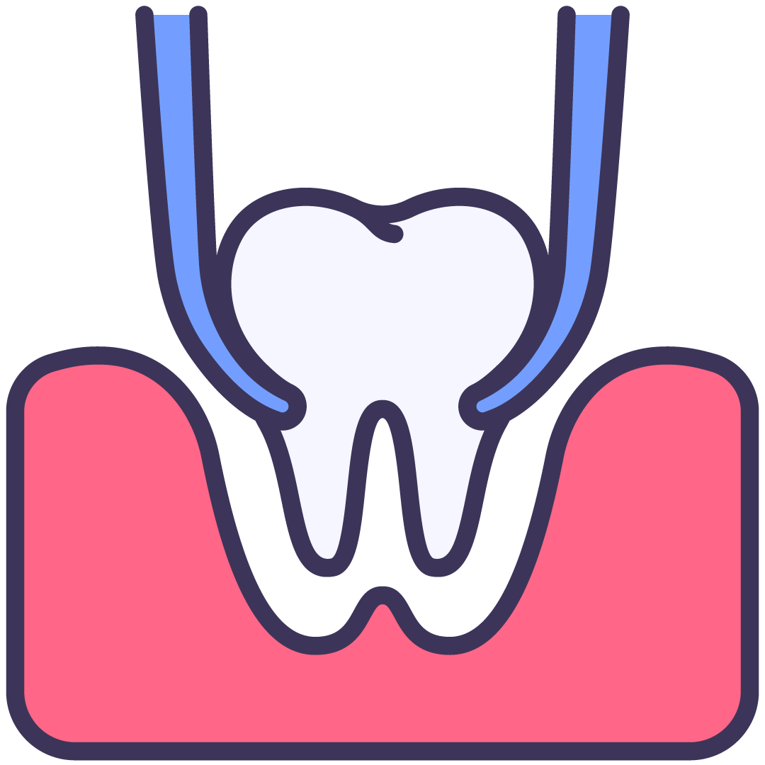 Removing Teeth | Wellington Point Dental Removing Teeth