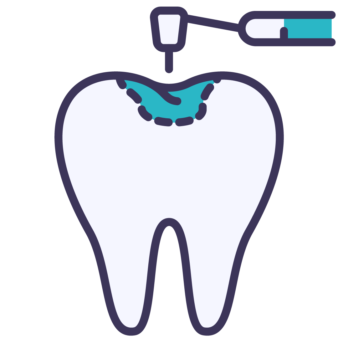 Teeth Fixing | Wellington Point Dental Teeth Fixing