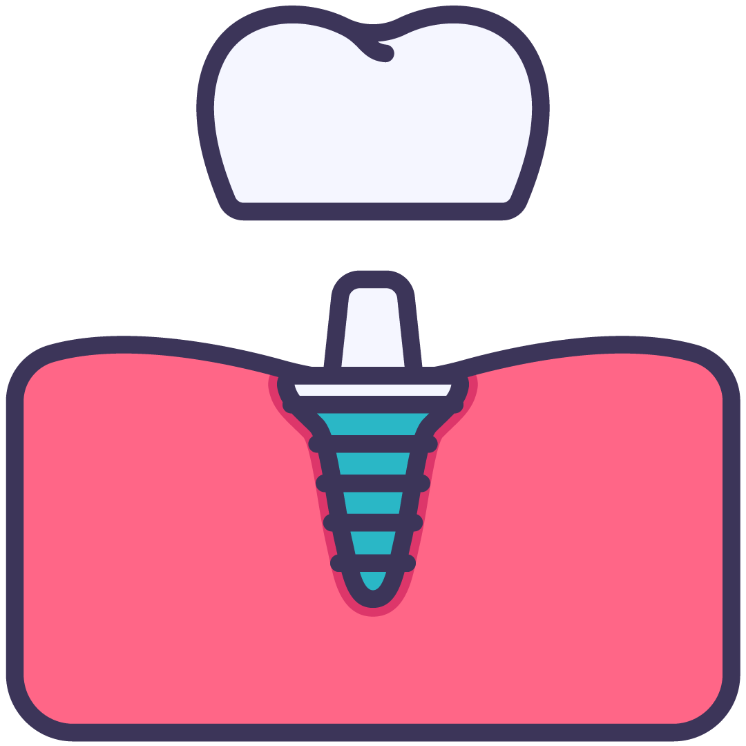 Dental Implants | Wellington Point Dental Dental Implants