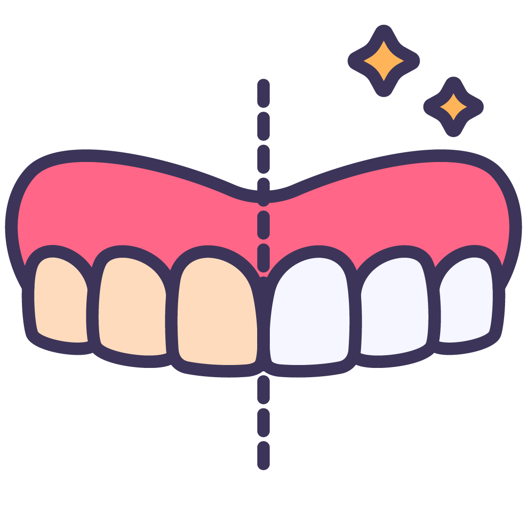 Before and After 2 | Wellington Point Dental Before and After 2