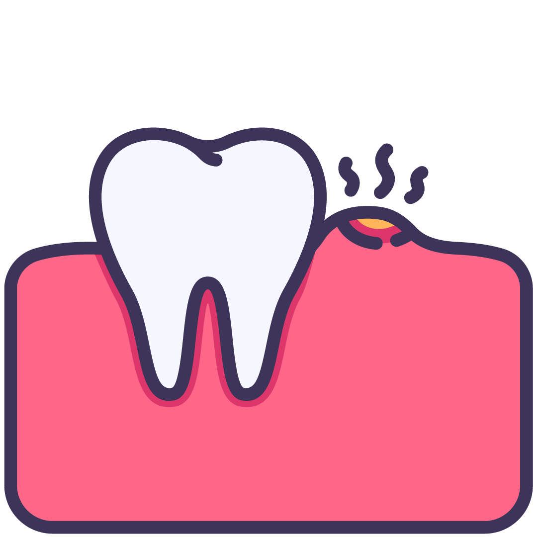 Tooth Pain | Wellington Point Dental Tooth Pain