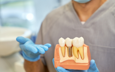 Dental Implants in Ormiston: Permanent Fix for Missing Teeth