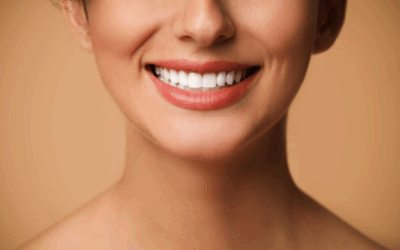 Cosmetic Dentistry In Ormiston: Enhance Your Smile with Veneers & Teeth Whitening