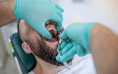 Tooth Extractions & Wisdom Teeth Removal in Thorneside