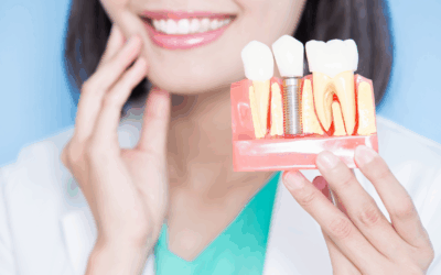 Dental Implants: A Long-Term Solution for Missing Teeth in Alexandra Hills