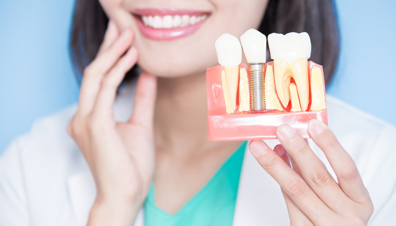 dental-implants-wellington-point-dental