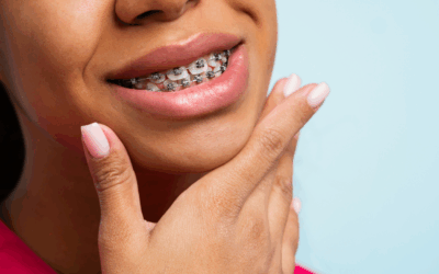 How Long Do Braces Take? Advice for Alexandra Hills Locals