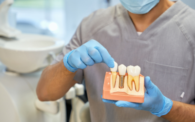 Dental Implants: A Long-Term Solution for Missing Teeth in Cleveland