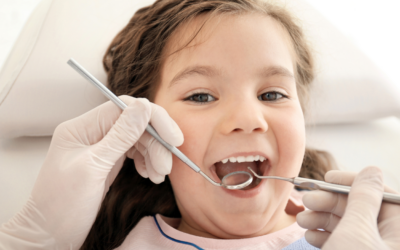 Dental Sealants for Children: Protecting Smiles in Birkdale