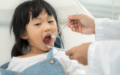 Children’s Oral Health: Fluoride and Preventive Care in Redland Bay