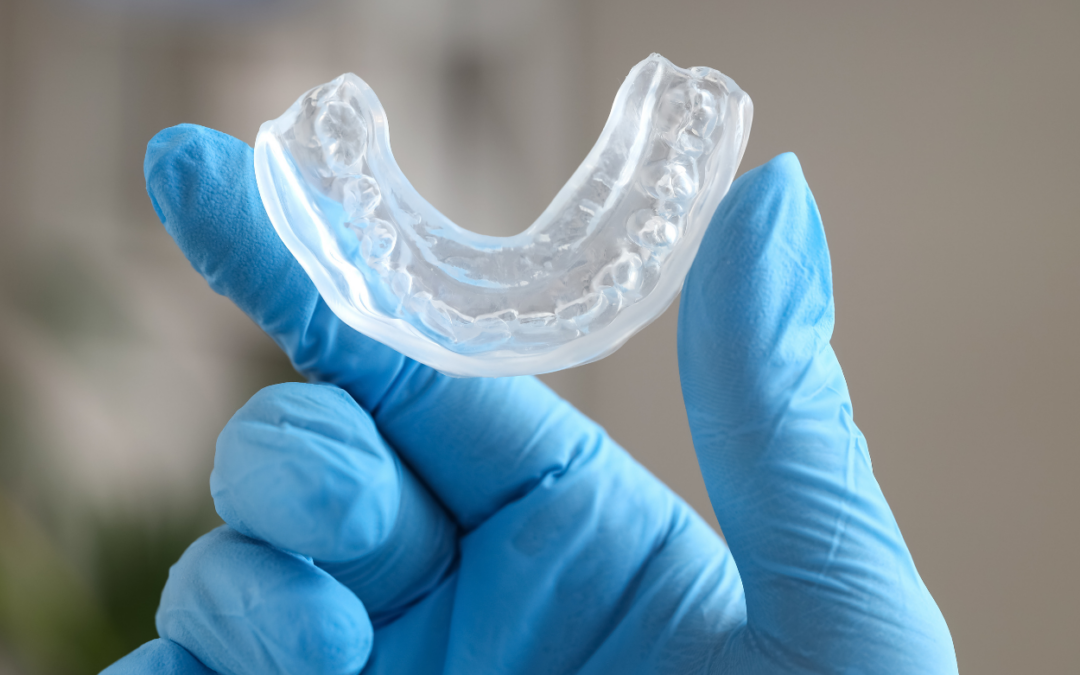 Mouthguards and Splints: Protecting Your Smile in Capalaba
