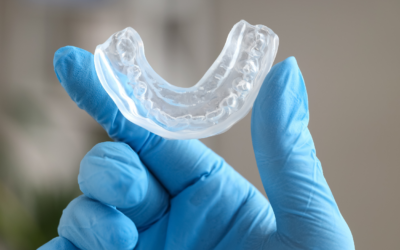 Mouthguards and Splints: Protecting Your Smile in Capalaba